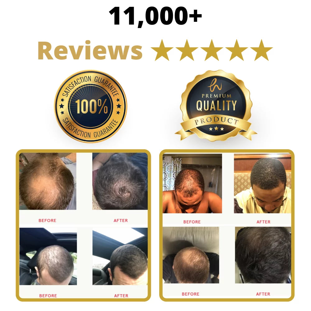 Caffeine Shampoo with Minoxidil for Men Hair Loss Kit E74251
