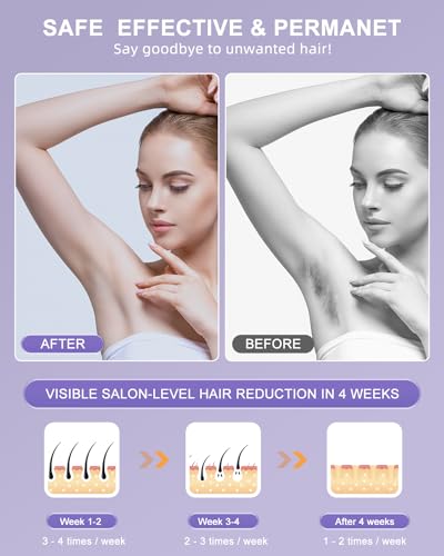 IPL Laser Hair Removal Device with Cooling for Face and Body O7857